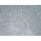 Immunohistochemistry - Anti-Wilms' Tumor 1 Antibody (V0140) - Antibodies.com