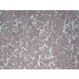 Immunohistochemistry - Anti-Wilms' Tumor 1 Antibody (V0140) - Antibodies.com