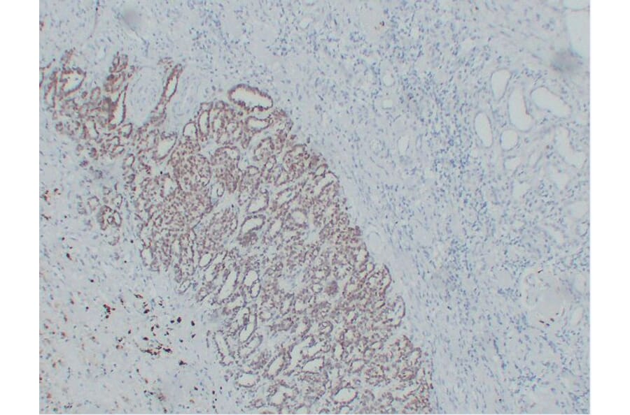 Immunohistochemistry - Anti-Wilms' Tumor 1 Antibody (V0140) - Antibodies.com