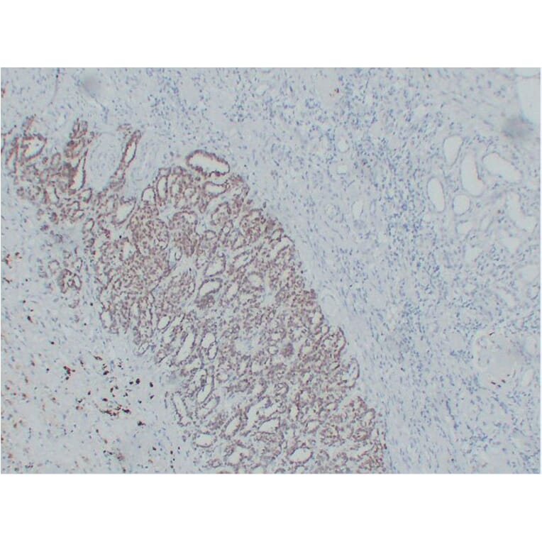 Immunohistochemistry - Anti-Wilms' Tumor 1 Antibody (V0140) - Antibodies.com