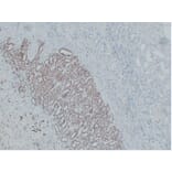 Immunohistochemistry - Anti-Wilms' Tumor 1 Antibody (V0140) - Antibodies.com