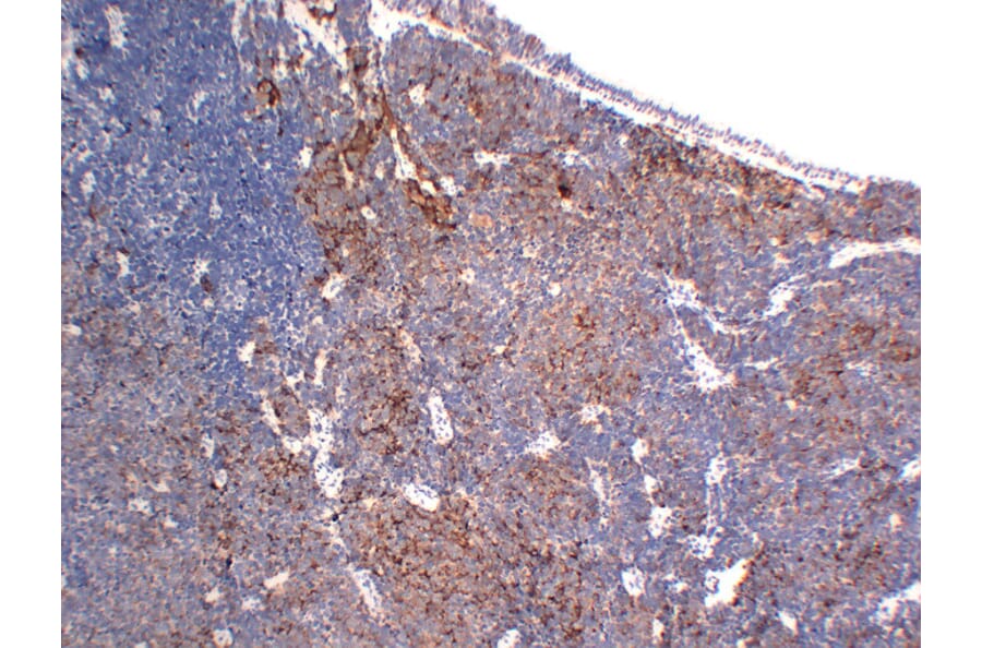 Immunohistochemistry - Anti-Chromogranin A Antibody (V0042) - Antibodies.com