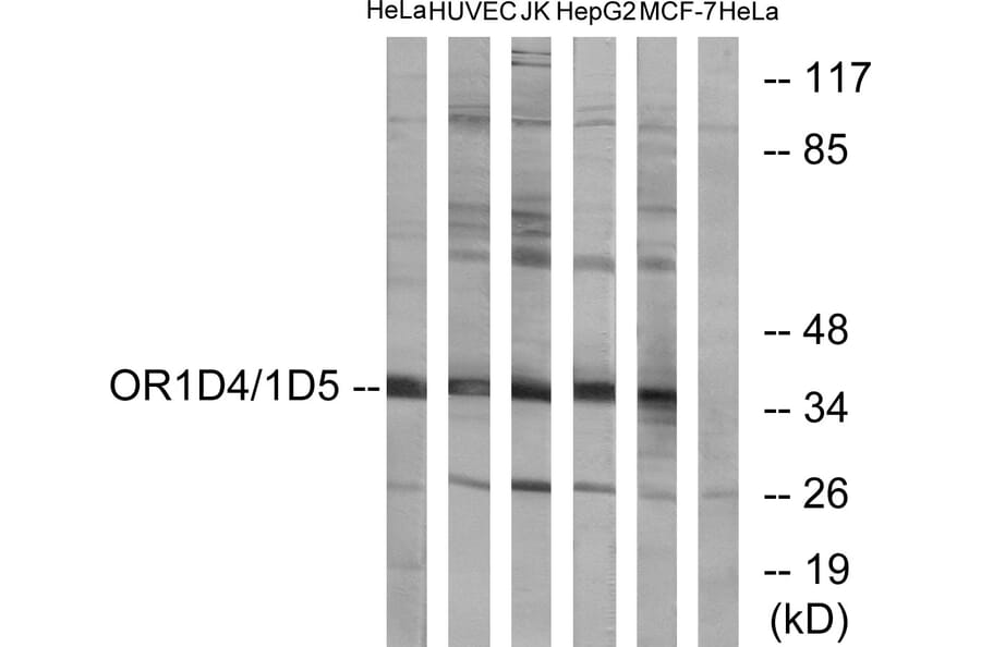 Western Blot - Anti-OR1D4 + OR1D5 Antibody (G885) - Antibodies.com