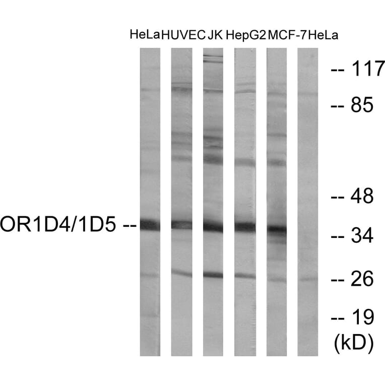 Western Blot - Anti-OR1D4 + OR1D5 Antibody (G885) - Antibodies.com