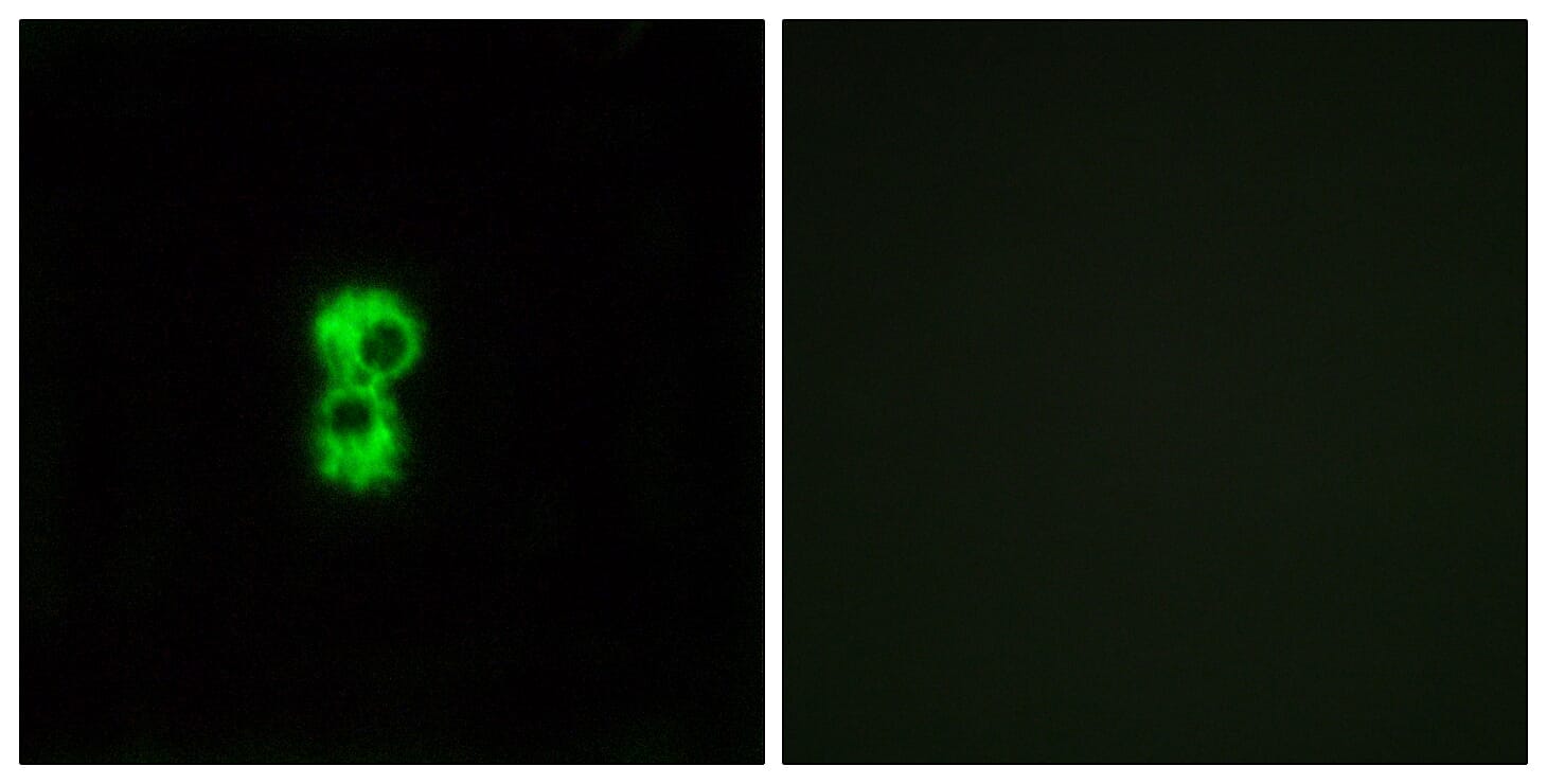 Immunofluorescence analysis of MCF7 cells using Anti-OR1D4 + OR1D5 Antibody. The right hand panel represents a negative control, where the antibody was pre-incubated with the immunising peptide.
