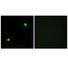 Immunofluorescence - Anti-Histone H2AX  Antibody (C10388) - Antibodies.com