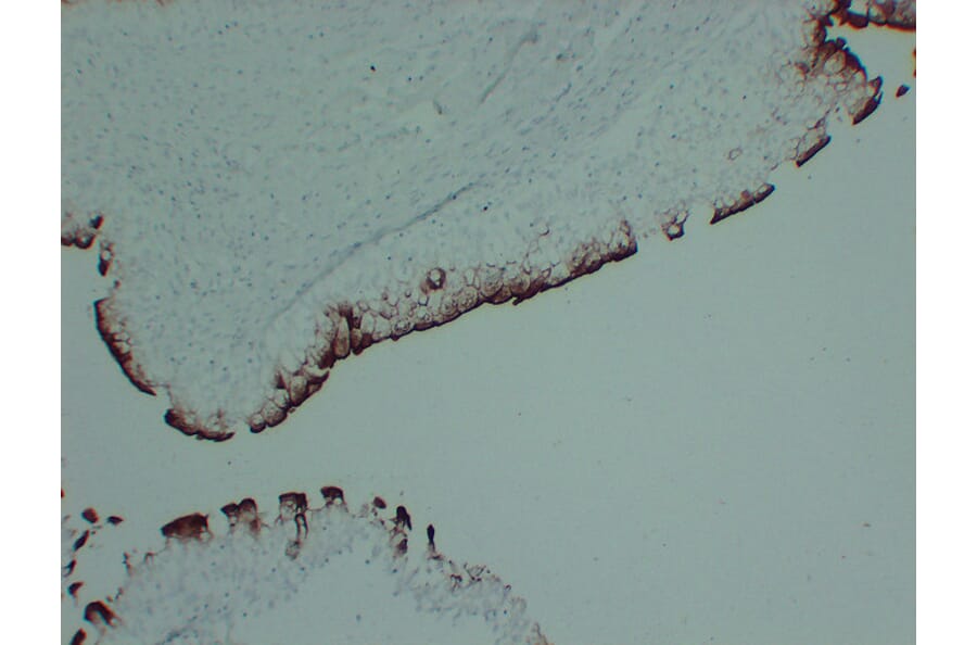 Immunohistochemistry - Anti-Uroplakin III Antibody (V0137) - Antibodies.com