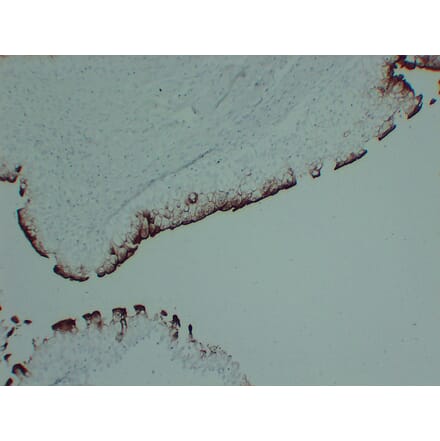Immunohistochemistry - Anti-Uroplakin III Antibody (V0137) - Antibodies.com