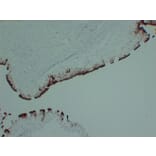Immunohistochemistry - Anti-Uroplakin III Antibody (V0137) - Antibodies.com