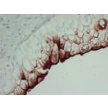 Immunohistochemistry - Anti-Uroplakin III Antibody (V0137) - Antibodies.com