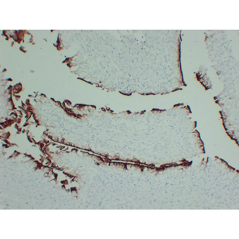 Immunohistochemistry - Anti-Uroplakin III Antibody (V0137) - Antibodies.com