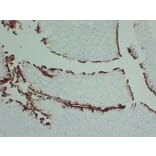 Immunohistochemistry - Anti-Uroplakin III Antibody (V0137) - Antibodies.com