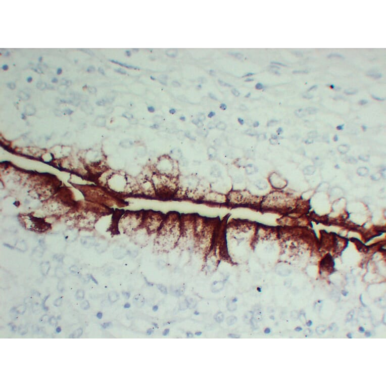 Immunohistochemistry - Anti-Uroplakin III Antibody (V0137) - Antibodies.com