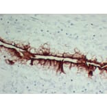 Immunohistochemistry - Anti-Uroplakin III Antibody (V0137) - Antibodies.com
