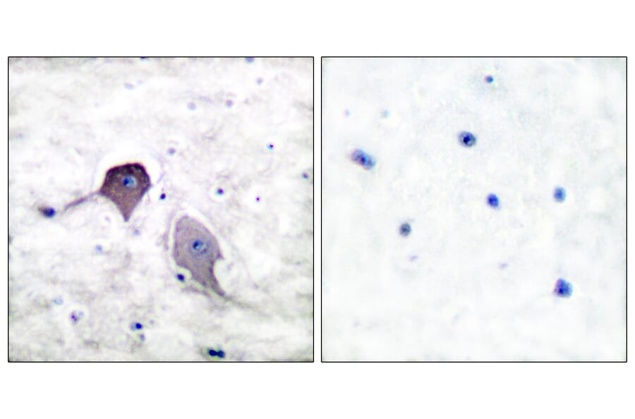 Immunohistochemistry - Anti-Presenilin 1 Antibody (C0308) - Antibodies.com