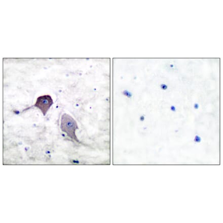 Immunohistochemistry - Anti-Presenilin 1 Antibody (C0308) - Antibodies.com