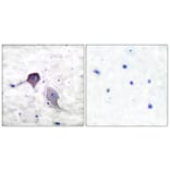 Immunohistochemistry - Anti-Presenilin 1 Antibody (C0308) - Antibodies.com