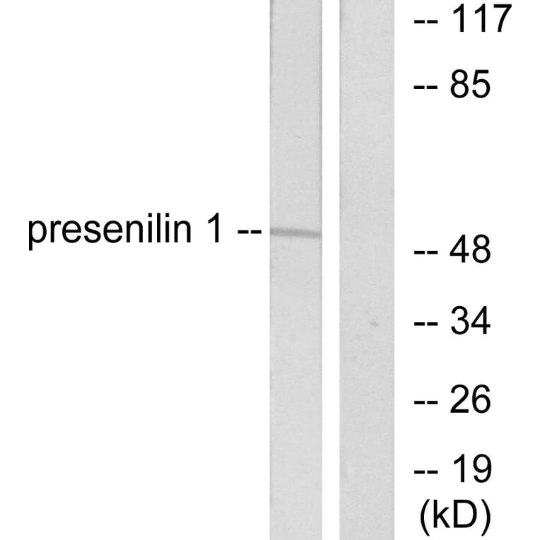 Western Blot - Anti-Presenilin 1 Antibody (C0308) - Antibodies.com
