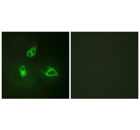 Immunofluorescence - Anti-IL-8R beta Antibody (B1066) - Antibodies.com