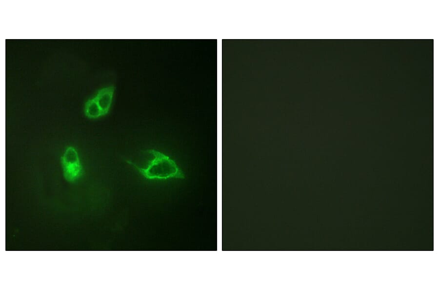 Immunofluorescence - Anti-IL-8R beta Antibody (B1066) - Antibodies.com