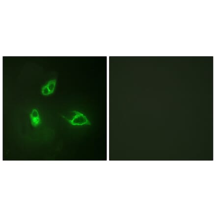 Immunofluorescence - Anti-IL-8R beta Antibody (B1066) - Antibodies.com