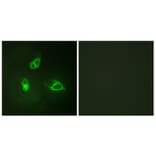 Immunofluorescence - Anti-IL-8R beta Antibody (B1066) - Antibodies.com