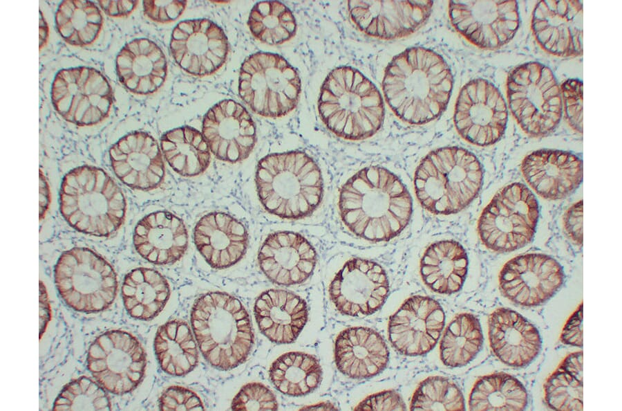 Anti-Claudin 4 Antibody [ABT-CLD4] (A97073) - IHC