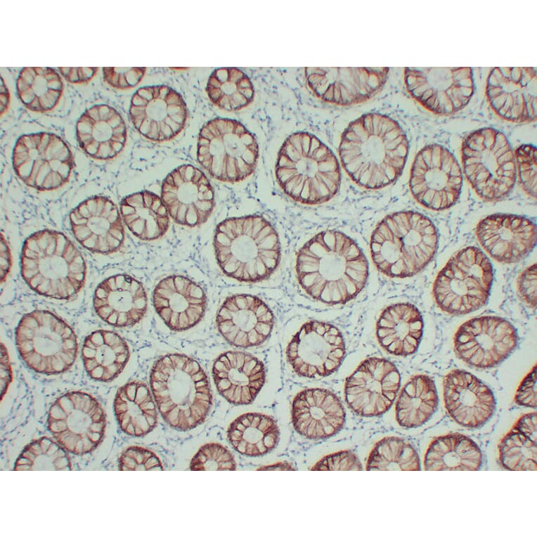 Immunohistochemistry - Anti-Claudin 4 Antibody (V0061) - Antibodies.com