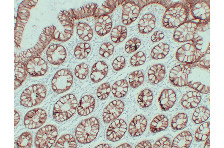 Immunohistochemistry - Anti-Claudin 4 Antibody (V0061) - Antibodies.com