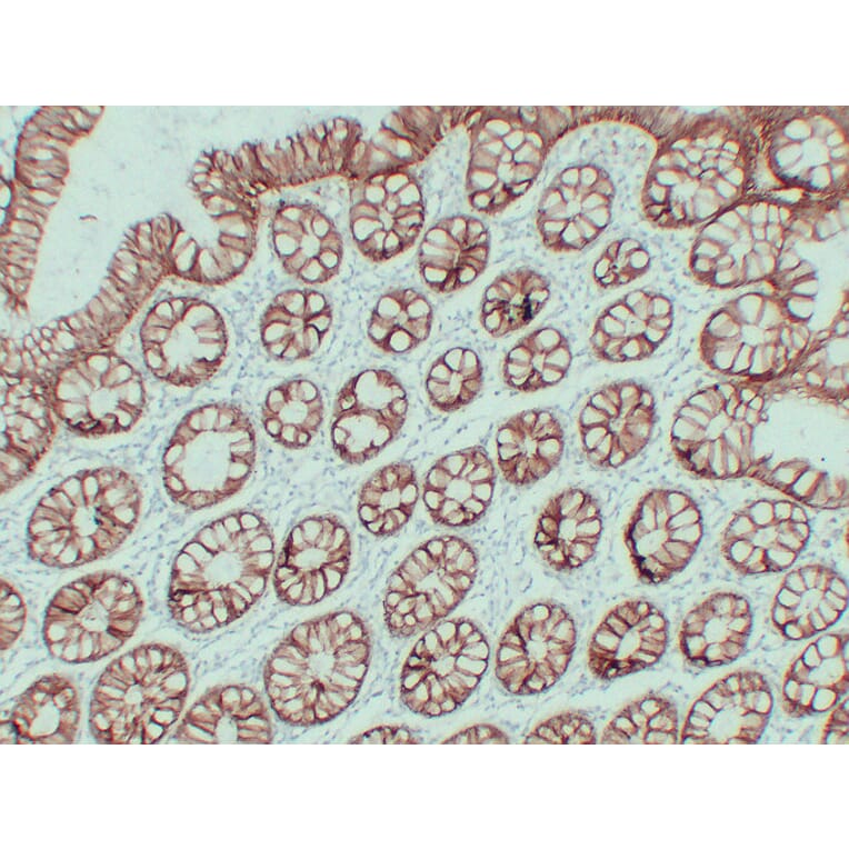 Immunohistochemistry - Anti-Claudin 4 Antibody (V0061) - Antibodies.com