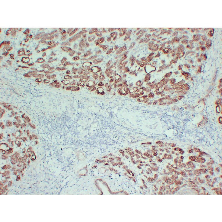 Immunohistochemistry - Anti-Claudin 4 Antibody (V0061) - Antibodies.com