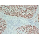 Immunohistochemistry - Anti-Claudin 4 Antibody (V0061) - Antibodies.com