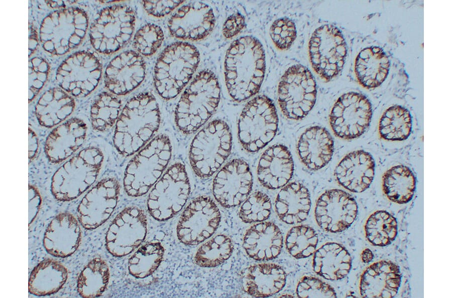 Immunohistochemistry - Anti-Claudin 3 Antibody (V0060) - Antibodies.com