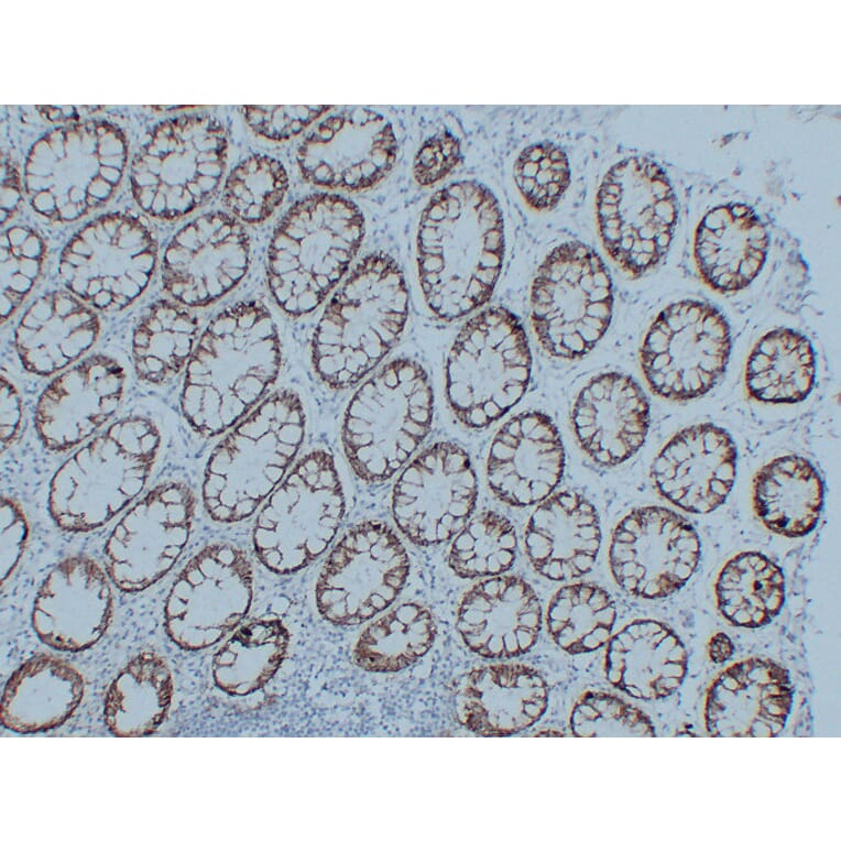 Immunohistochemistry - Anti-Claudin 3 Antibody (V0060) - Antibodies.com