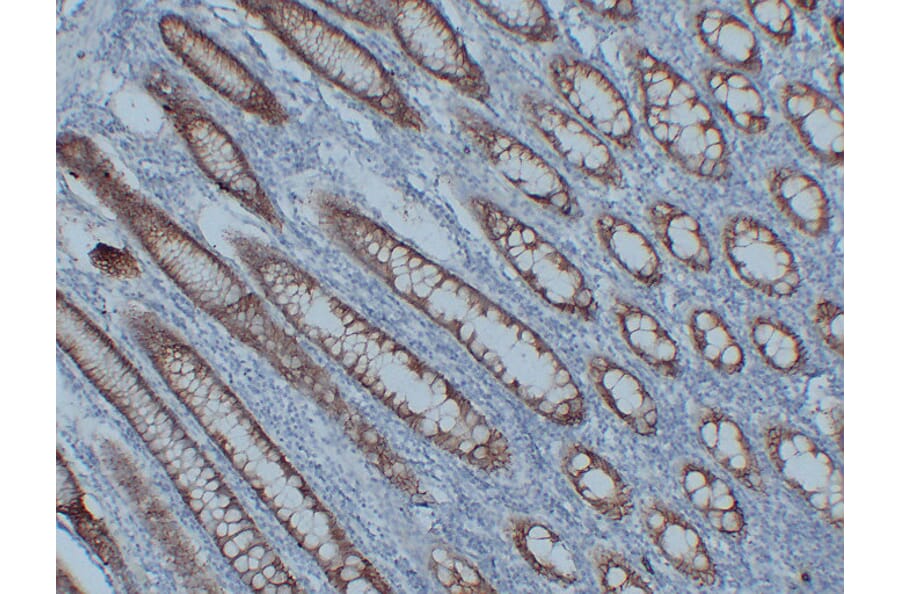 Immunohistochemistry - Anti-Claudin 3 Antibody (V0060) - Antibodies.com