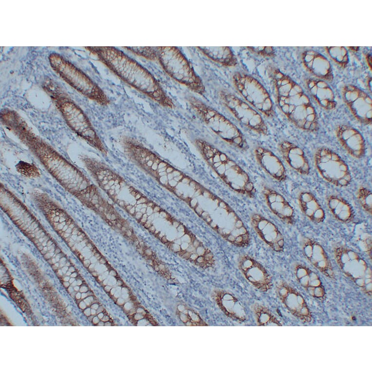 Immunohistochemistry - Anti-Claudin 3 Antibody (V0060) - Antibodies.com