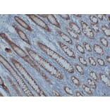 Immunohistochemistry - Anti-Claudin 3 Antibody (V0060) - Antibodies.com