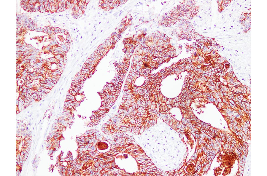 Immunohistochemistry - Anti-Claudin 3 Antibody (V0060) - Antibodies.com