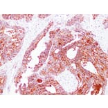 Immunohistochemistry - Anti-Claudin 3 Antibody (V0060) - Antibodies.com