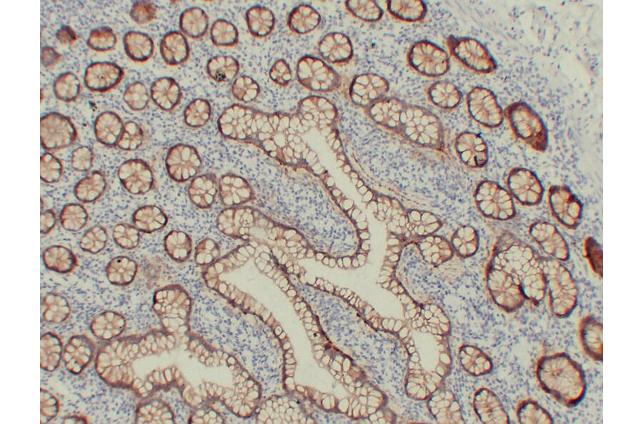 Immunohistochemistry - Anti-Claudin 3 Antibody (V0060) - Antibodies.com