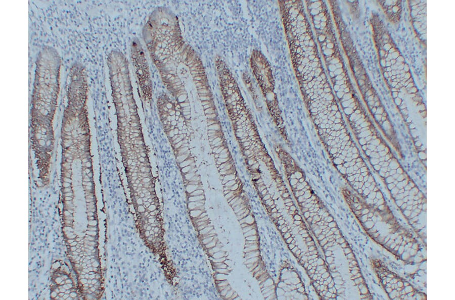 Immunohistochemistry - Anti-Claudin 3 Antibody (V0060) - Antibodies.com