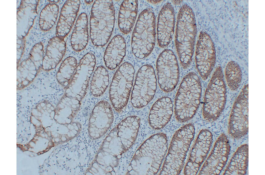 Immunohistochemistry - Anti-Claudin 3 Antibody (V0060) - Antibodies.com