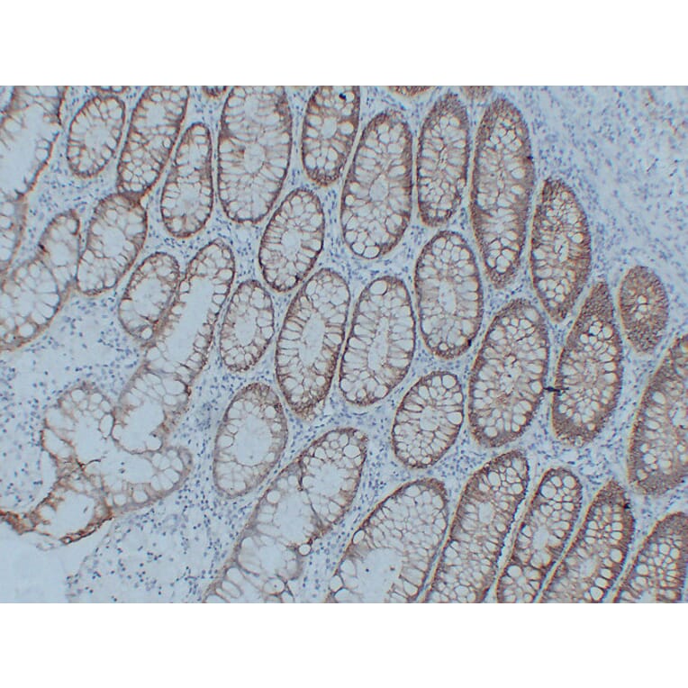 Immunohistochemistry - Anti-Claudin 3 Antibody (V0060) - Antibodies.com