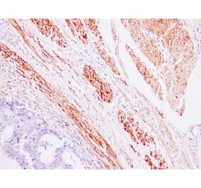 Immunohistochemistry - Anti-Caldesmon Antibody (V0012) - Antibodies.com