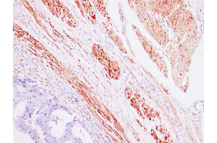 Immunohistochemistry - Anti-Caldesmon Antibody (V0012) - Antibodies.com