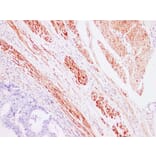Immunohistochemistry - Anti-Caldesmon Antibody (V0012) - Antibodies.com