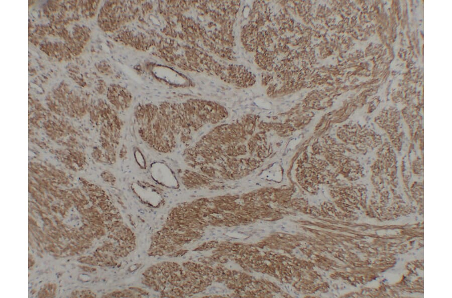 Immunohistochemistry - Anti-Caldesmon Antibody (V0012) - Antibodies.com