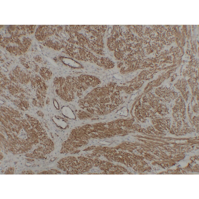 Immunohistochemistry - Anti-Caldesmon Antibody (V0012) - Antibodies.com