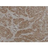 Immunohistochemistry - Anti-Caldesmon Antibody (V0012) - Antibodies.com