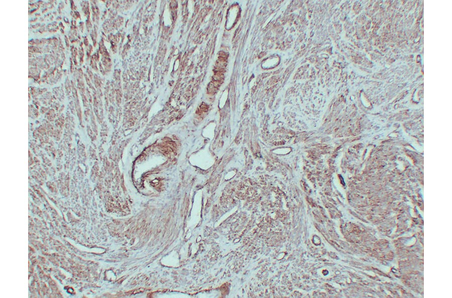 Immunohistochemistry - Anti-Caldesmon Antibody (V0012) - Antibodies.com